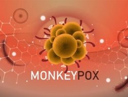 Pandemi Monkeypox: Penyebab, Gejala, dan Tindakan Pencegahan